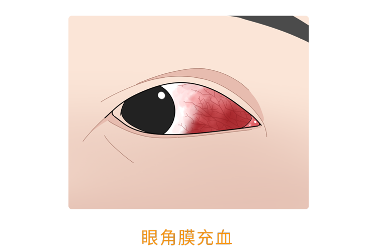 人体缺乏维生素B2,身体3个部位会慢慢“提醒”你,及时补充