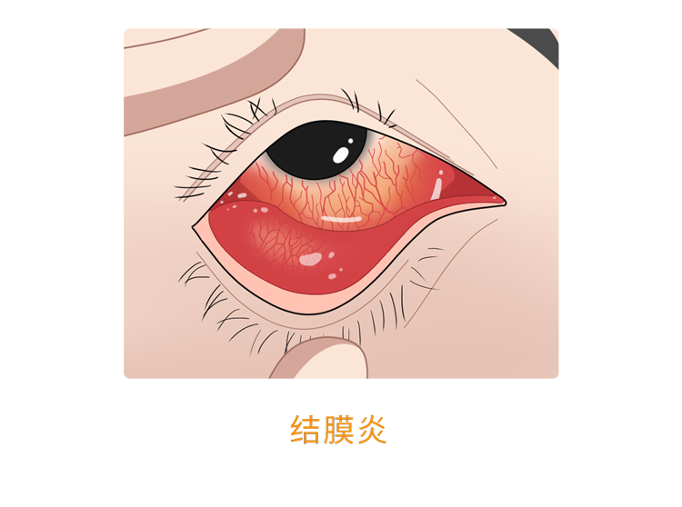 人体缺乏维生素B2,身体3个部位会慢慢“提醒”你,及时补充