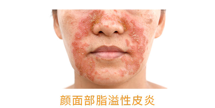 人体缺乏维生素B2,身体3个部位会慢慢“提醒”你,及时补充