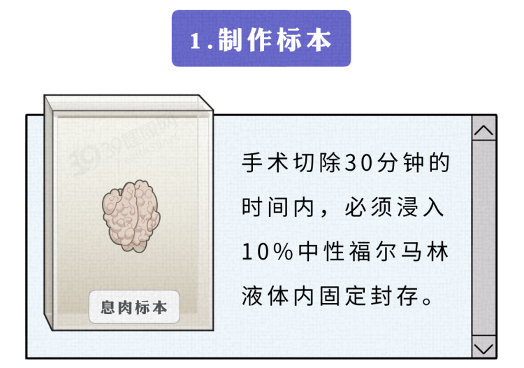 手术切掉的人体器官，最后流去了哪儿？为什么病人不能带走？