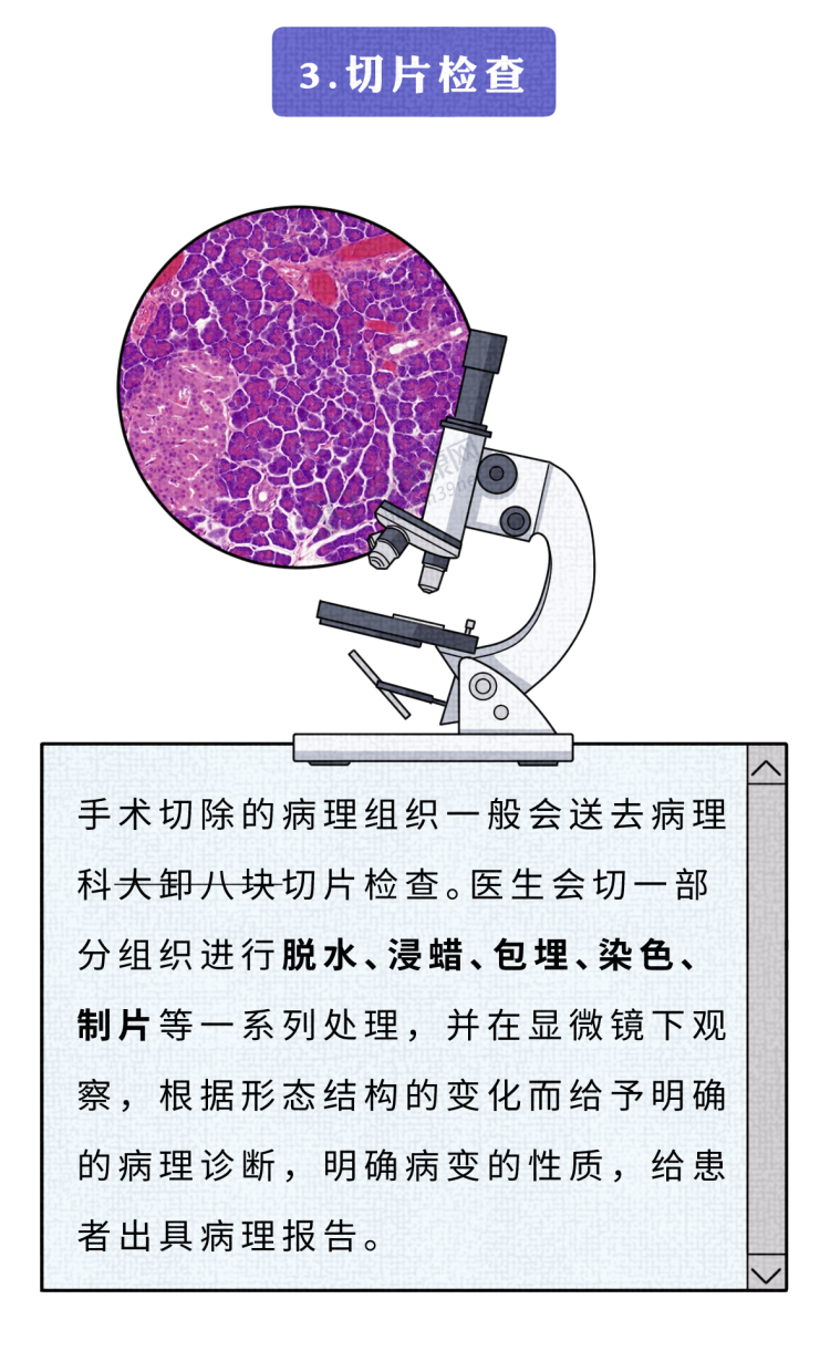 手术切掉的人体器官，最后流去了哪儿？为什么病人不能带走？