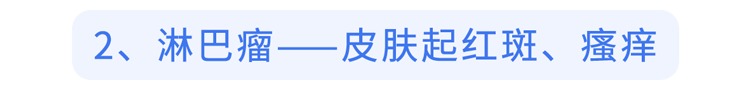 不要错把艾滋当皮肤病！提醒：出现3个皮肤症状，或是艾滋的信号