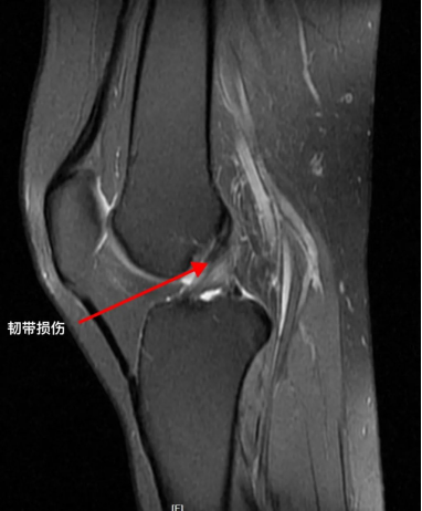 X线、CT、磁共振有何区别?看这一篇你就懂了