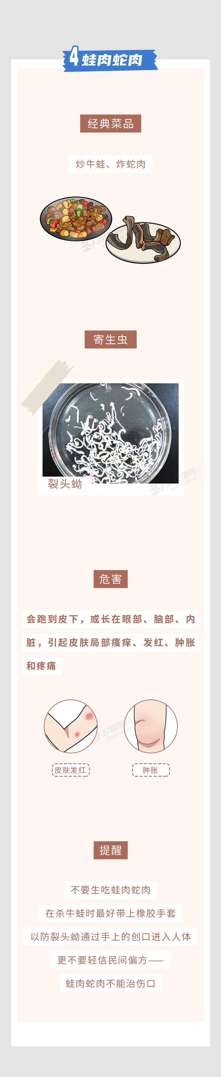 提醒：6种食物是寄生虫的“重灾区”，宁愿少吃或不吃，也别贪嘴
