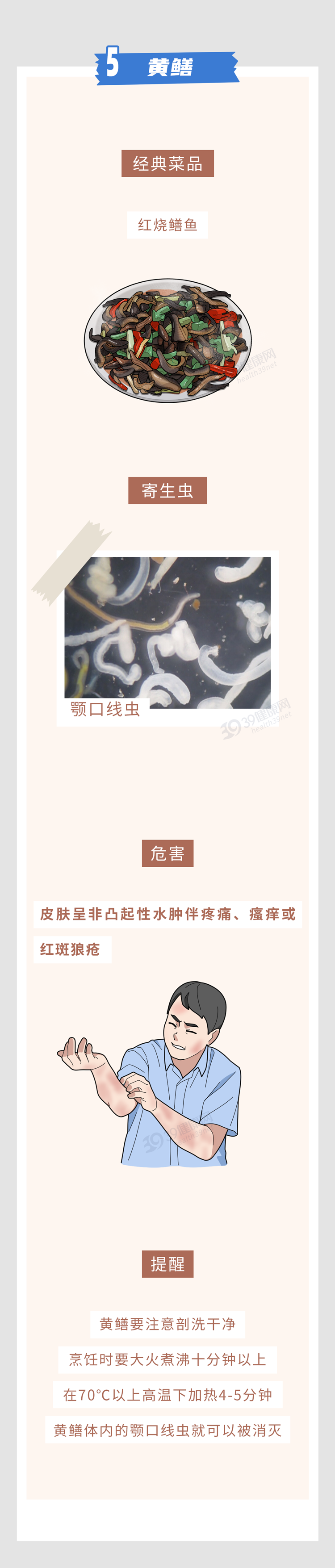 提醒：6种食物是寄生虫的“重灾区”，宁愿少吃或不吃，也别贪嘴