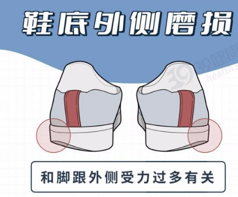 身体好不好,看鞋就知道?提醒:鞋底穿成4个模样,该留意了