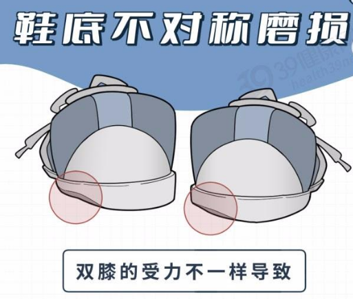 身体好不好,看鞋就知道?提醒:鞋底穿成4个模样,该留意了
