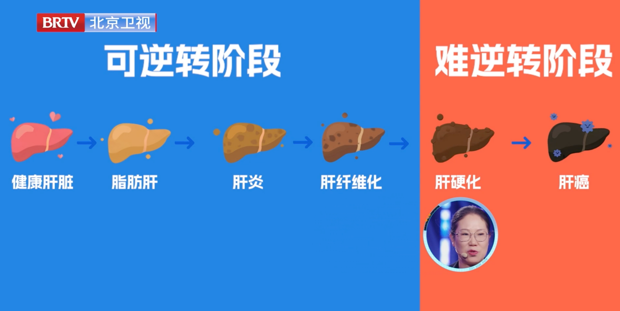 Ȫ粻ӡaiڿƼFibroScan֬жΣ