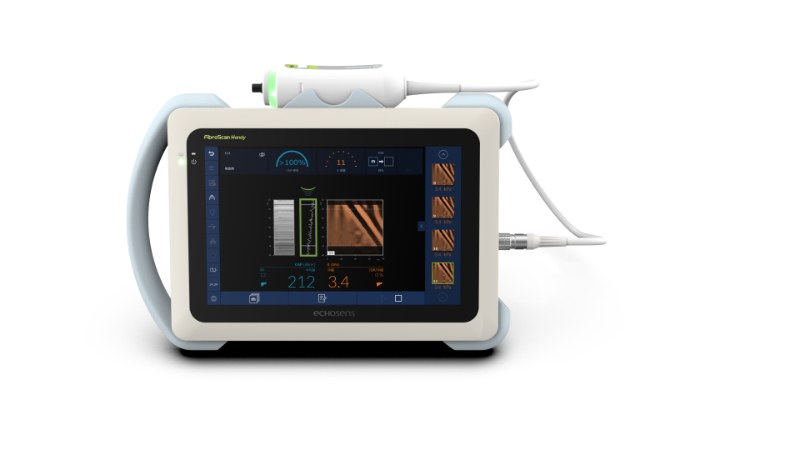 Ȫ粻ӡaiڿƼFibroScan֬жΣ