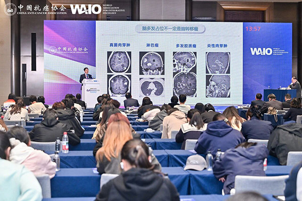 2025CACA西北整合肿瘤学大会在西安召开