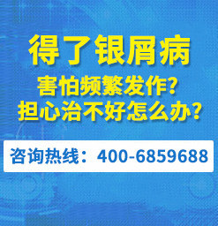 广东牛皮癣:在广州医院治疗银屑病费用高吗