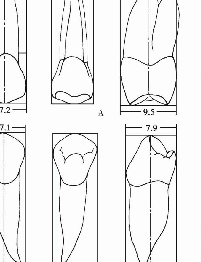 anterior teeth 也分为上