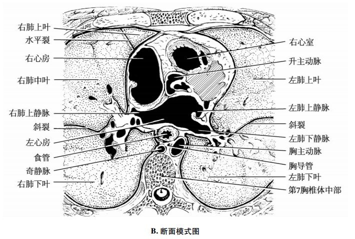 左心耳断层解剖图图片