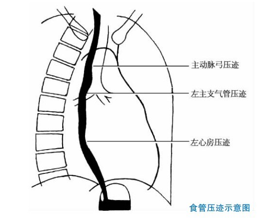 【圖】胸片心影解剖:x線攝片檢查 -心血管-醫學名詞-39疾病百科