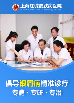 上海治疗牛皮癣医院
