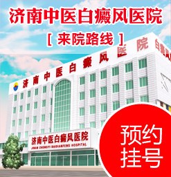 济南白癜风治疗医院排名具体名单
