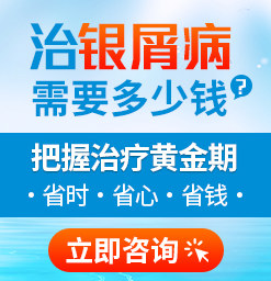 潍坊治疗牛皮癣专科医院有吗