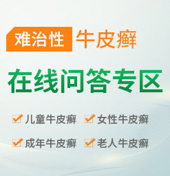 潍坊治疗牛皮癣的医院哪家好