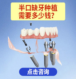武汉中诺口腔医院种植牙多少钱？