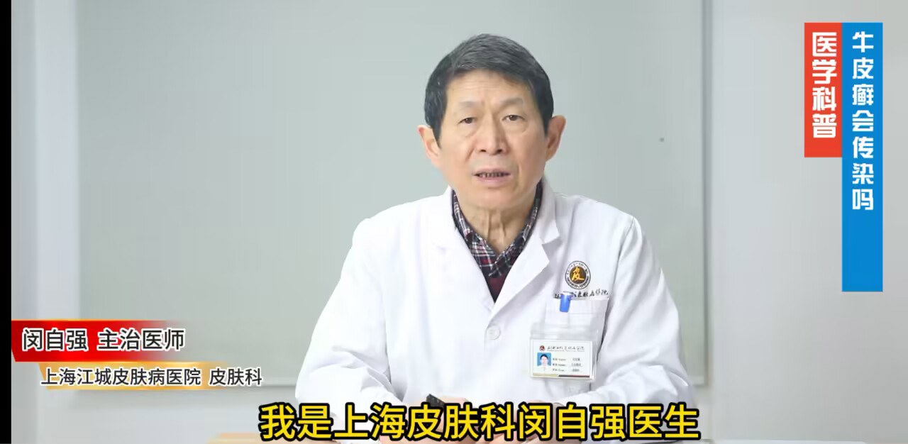 上海银屑病医院闵自强回答：牛皮癣会不会传染给别人