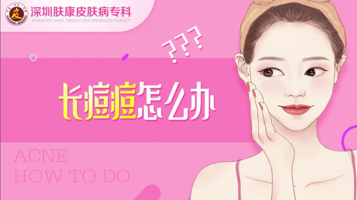 深圳肤康皮肤病专科周贤明医生讲解：长痘痘怎么办？