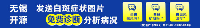 无锡市开源白癜风