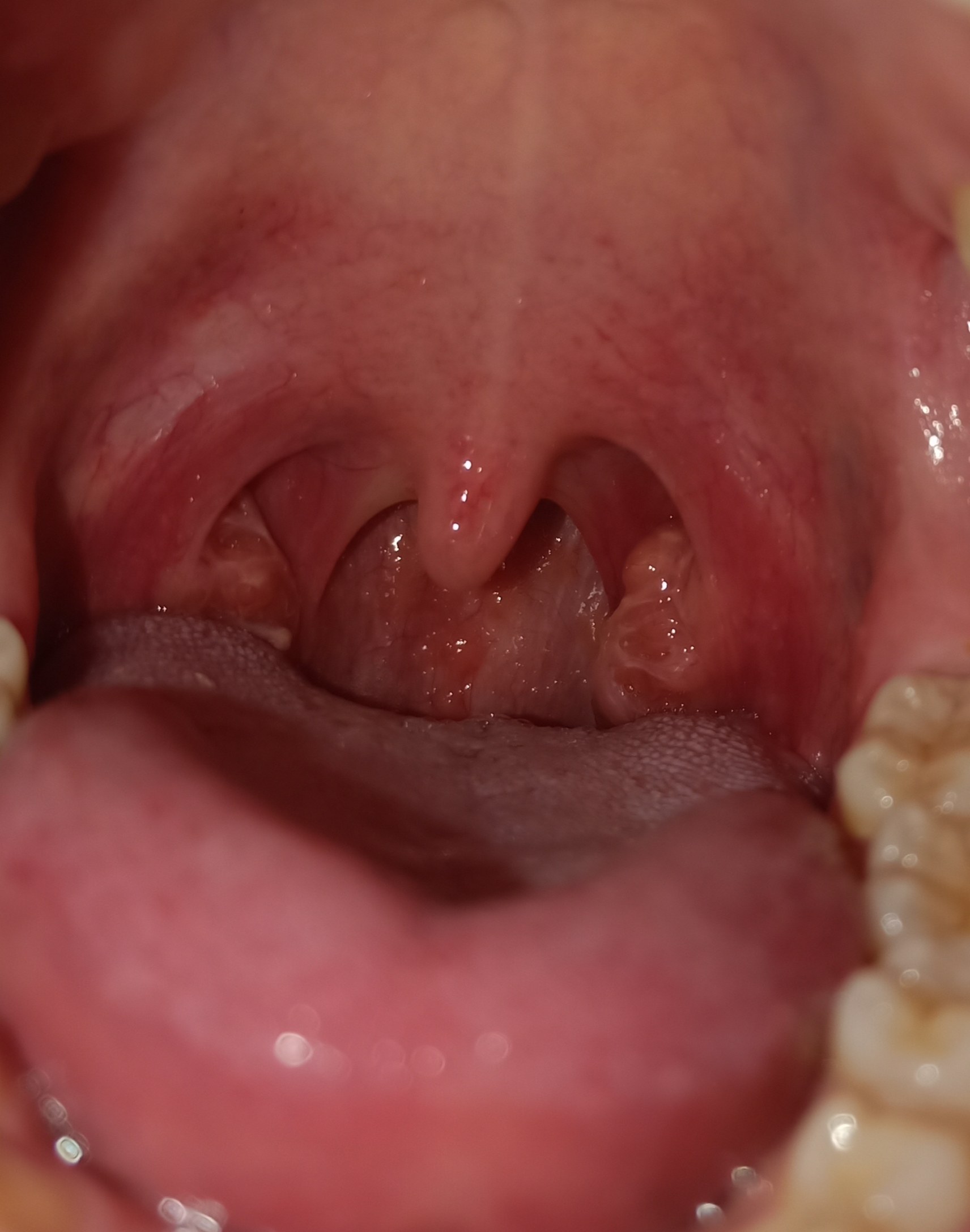健康喉咙内部图片图片