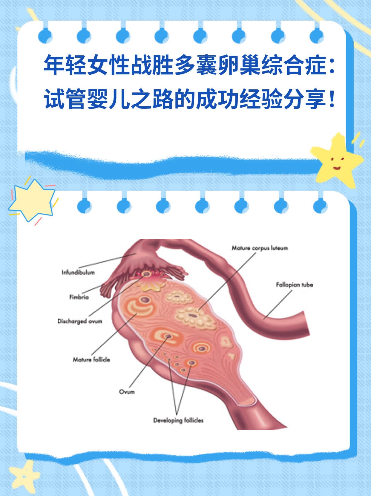 年轻女性战胜多囊卵巢综合症：试管婴儿之路的成功经验分享！