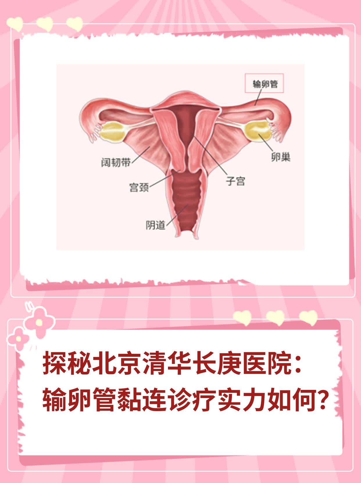 探秘北京清华长庚医院：输卵管黏连诊疗实力如何？