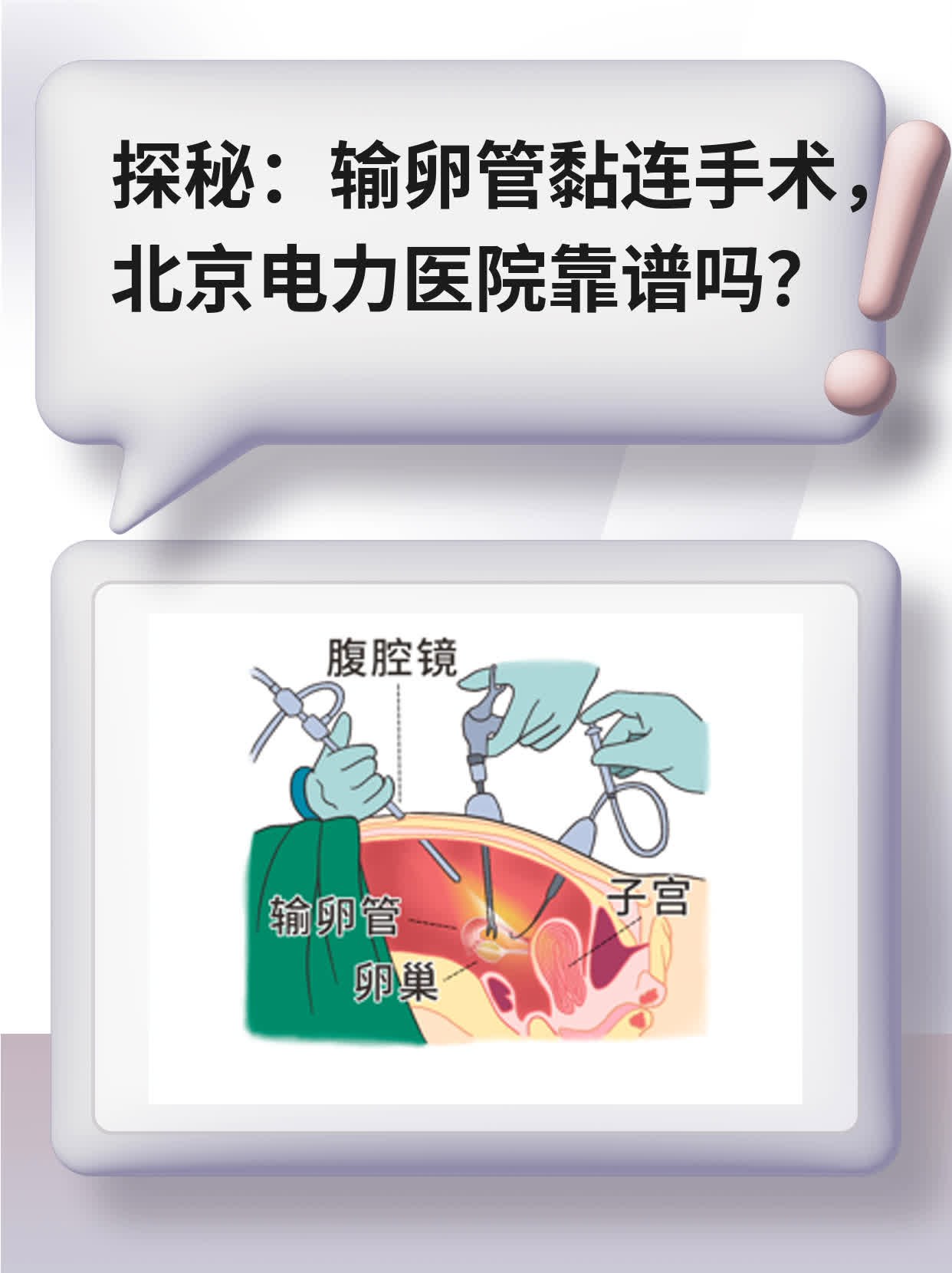 探秘：输卵管黏连手术，北京电力医院靠谱吗？