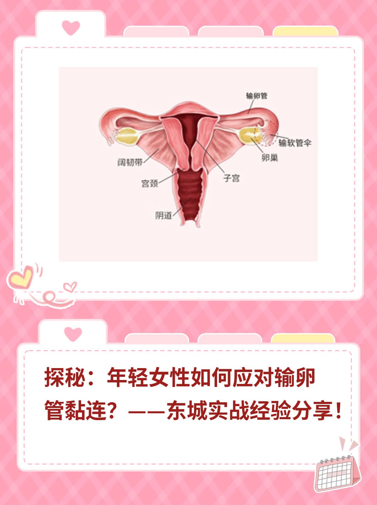 探秘：年轻女性如何应对输卵管黏连？——东城实战经验分享！
