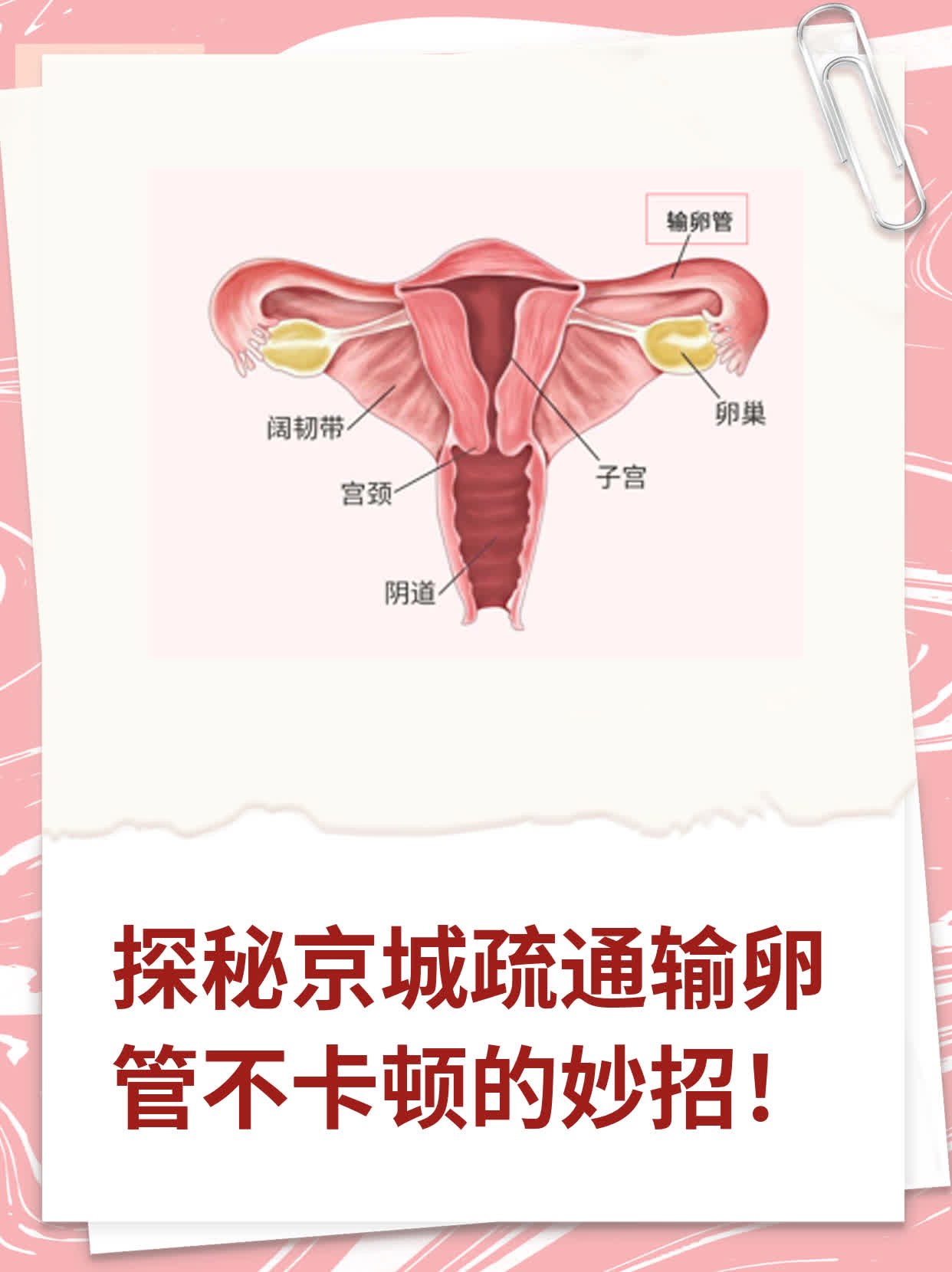 北京首都医科大输卵管通而不畅医院