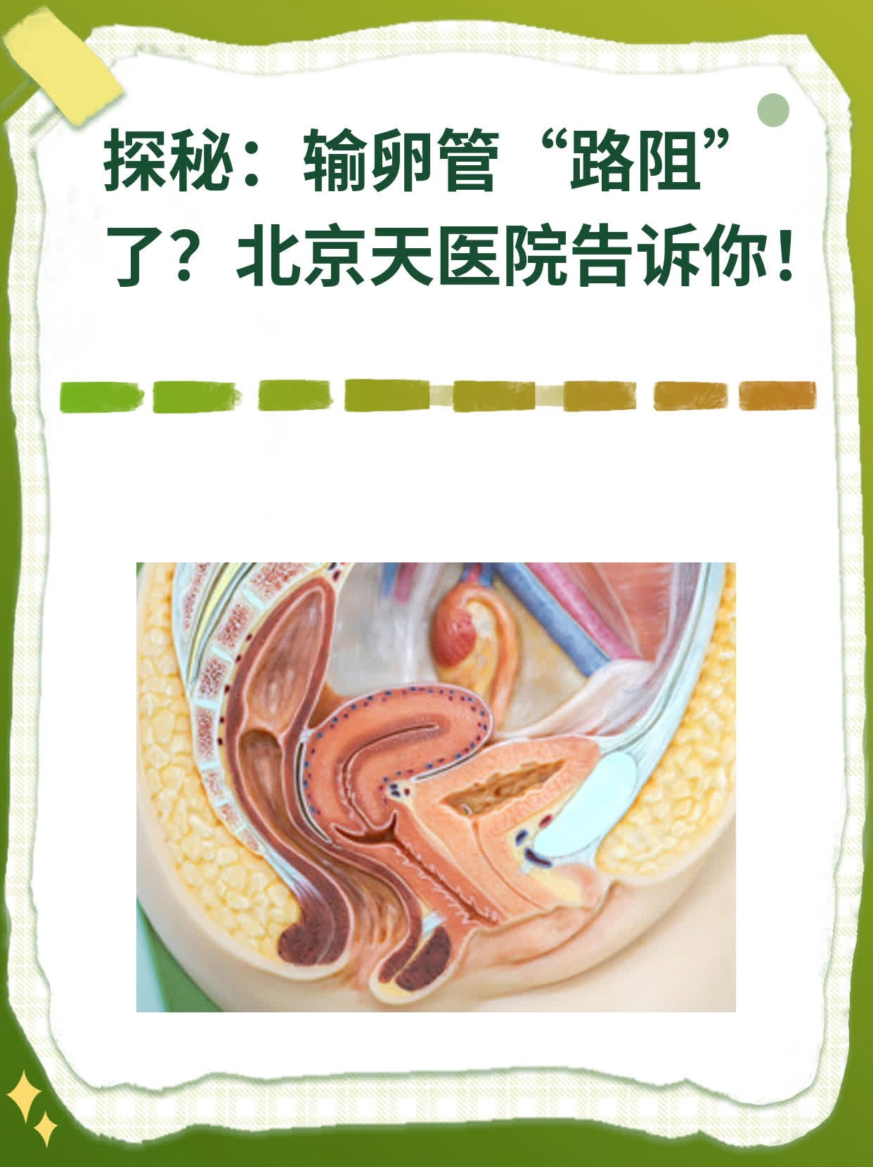 探秘：输卵管“路阻”了？北京天医院告诉你！