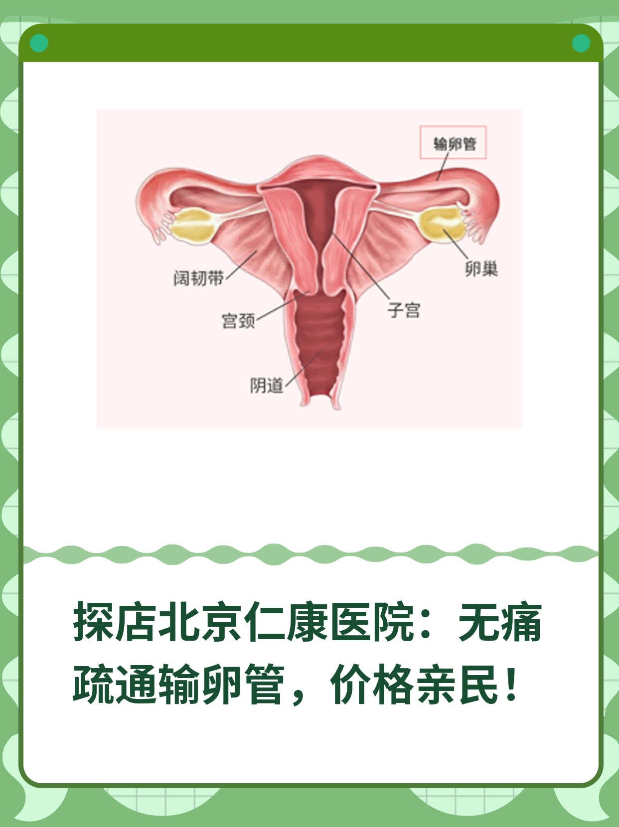 探店北京仁康医院：无痛疏通输卵管，价格亲民！
