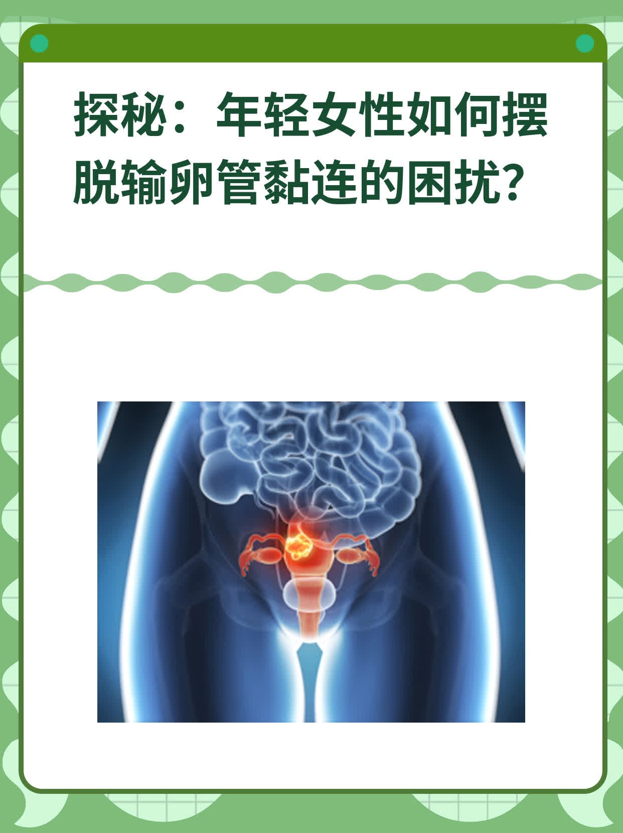 探秘：年轻女性如何摆脱输卵管黏连的困扰？