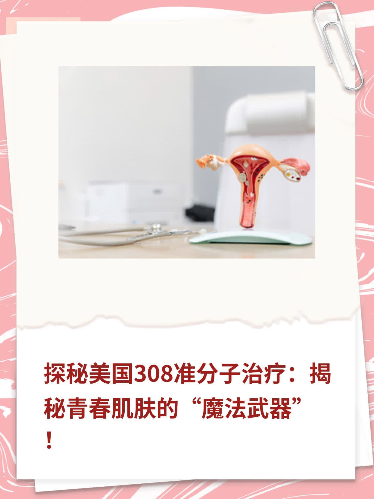 探秘美国308准分子治疗：揭秘青春肌肤的“魔法武器”！