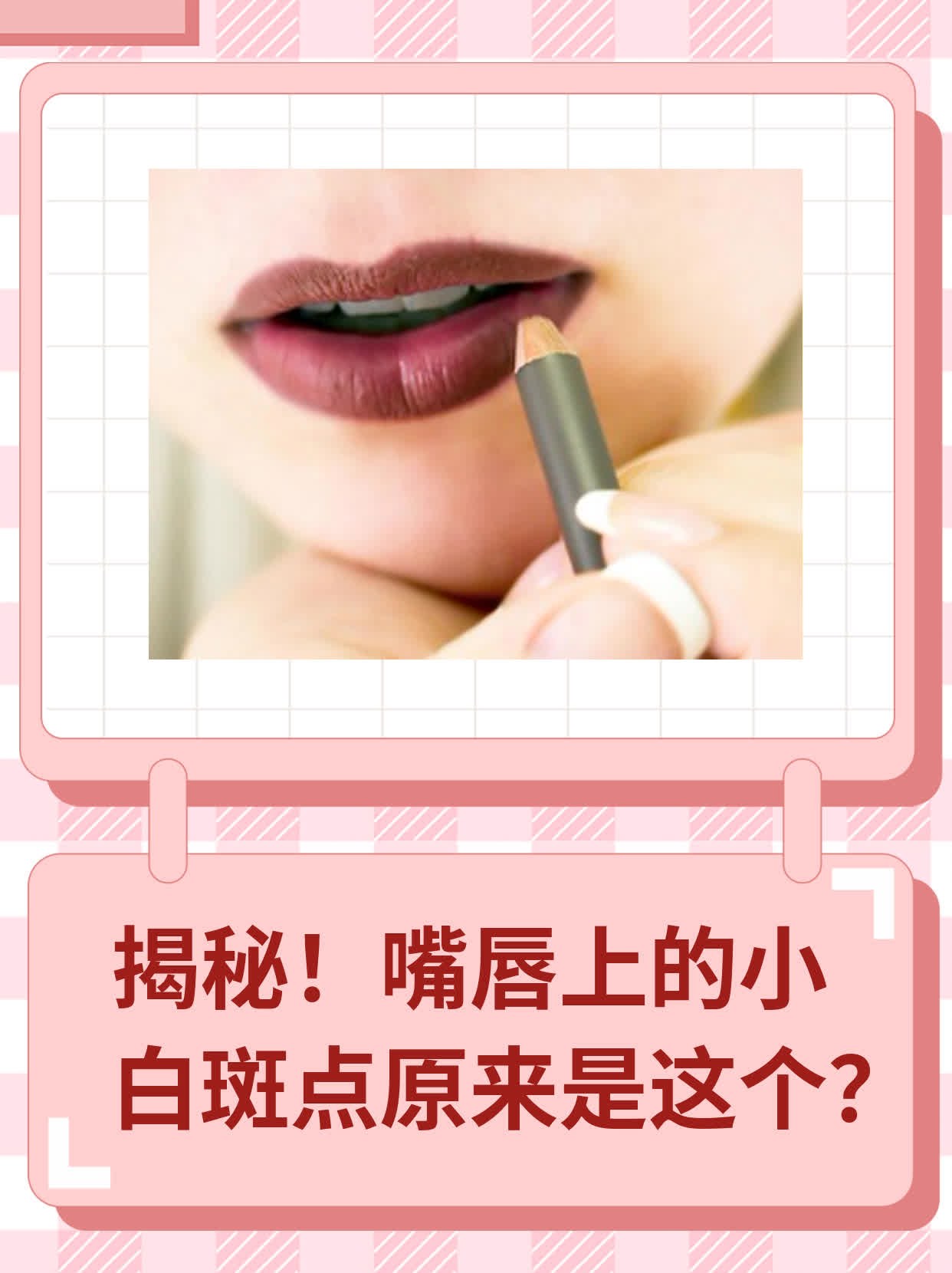 揭秘！嘴唇上的小白斑点原来是这个？