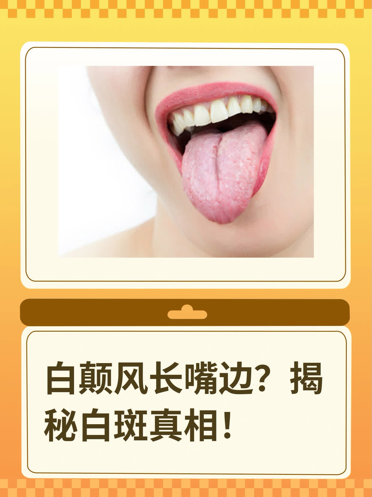 白颠风长嘴边？揭秘白斑真相！