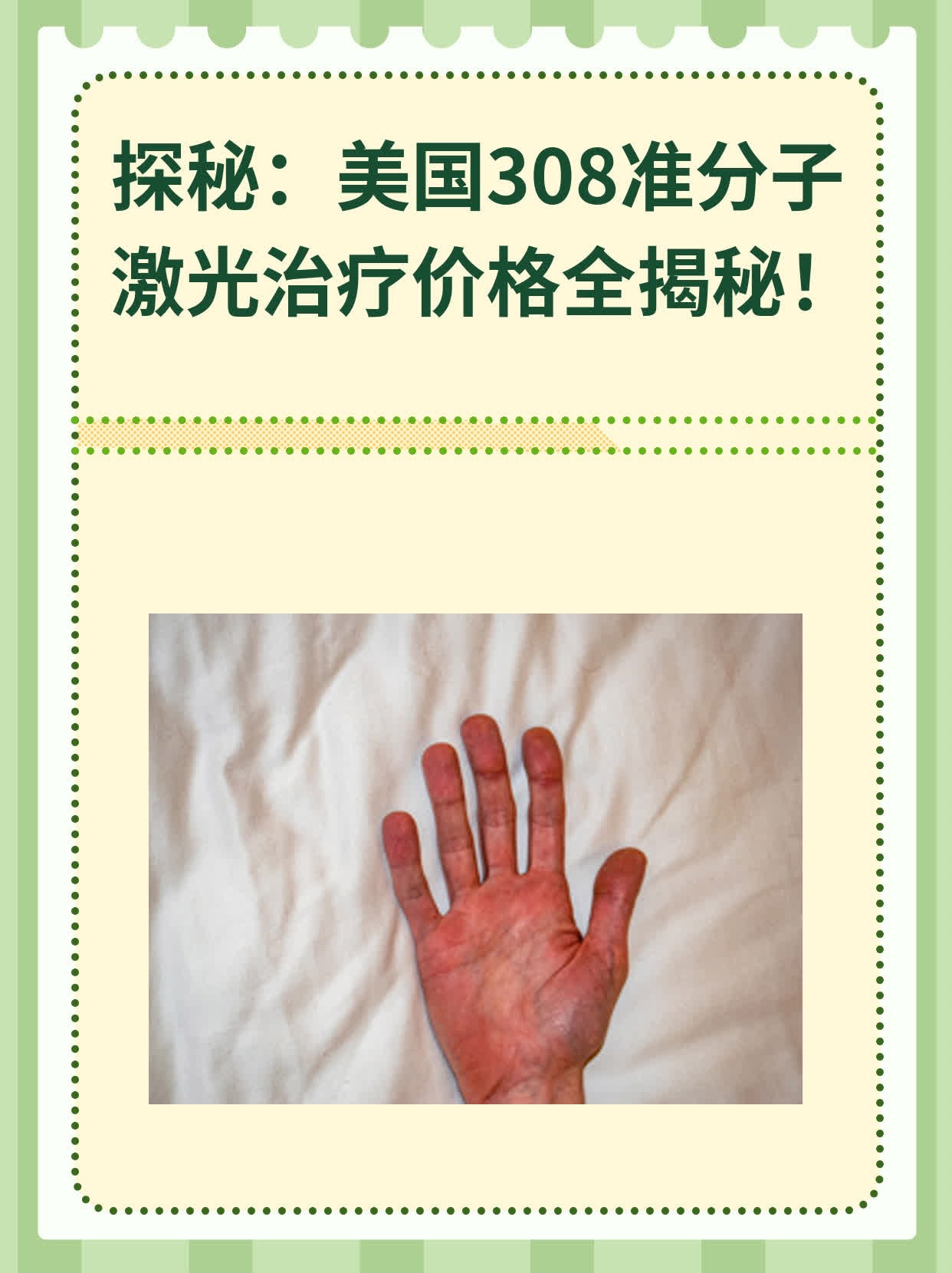 探秘：美国308准分子激光治疗价格全揭秘！