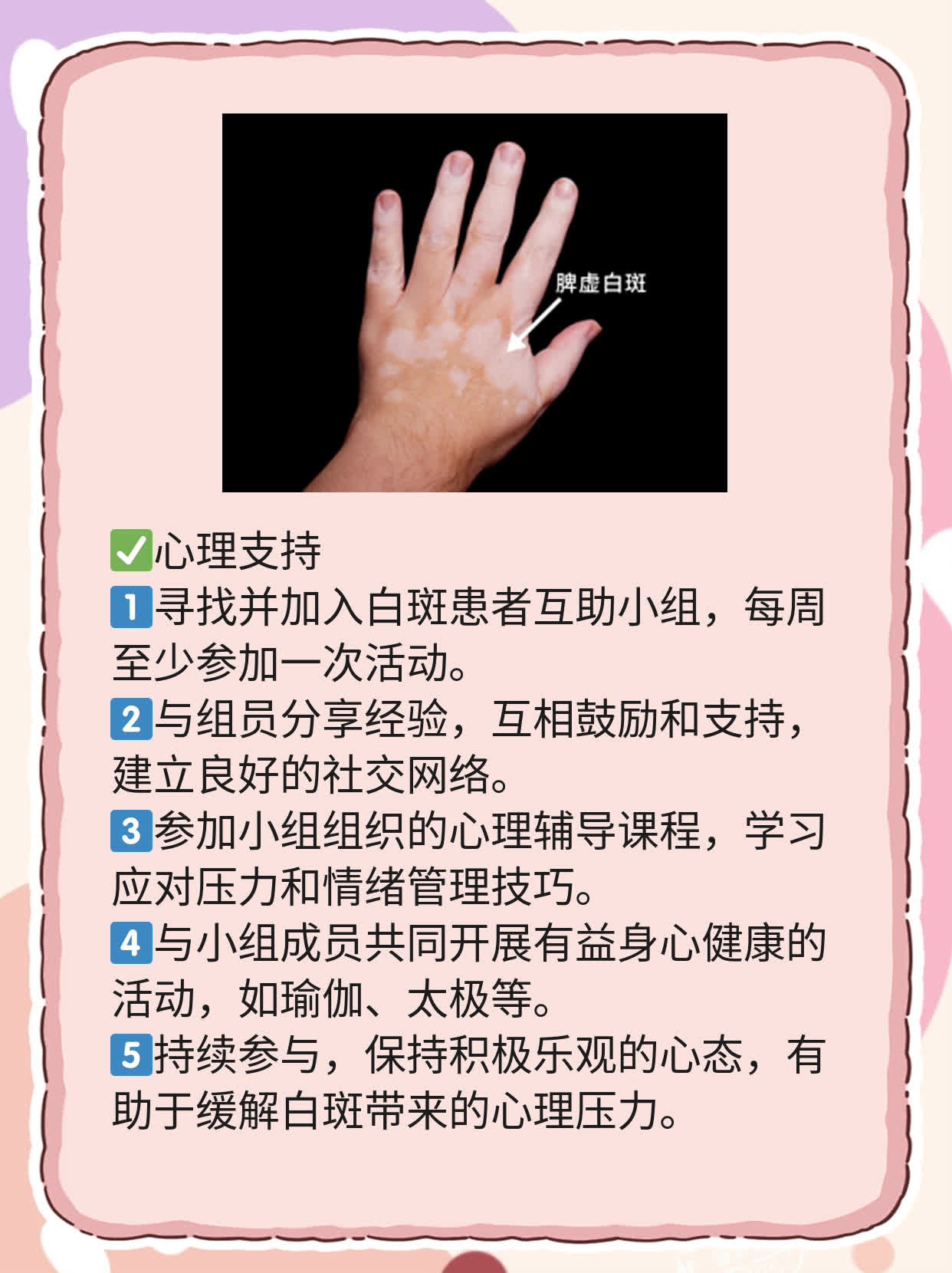 308nm准分子光，治白斑，钱花得值吗？