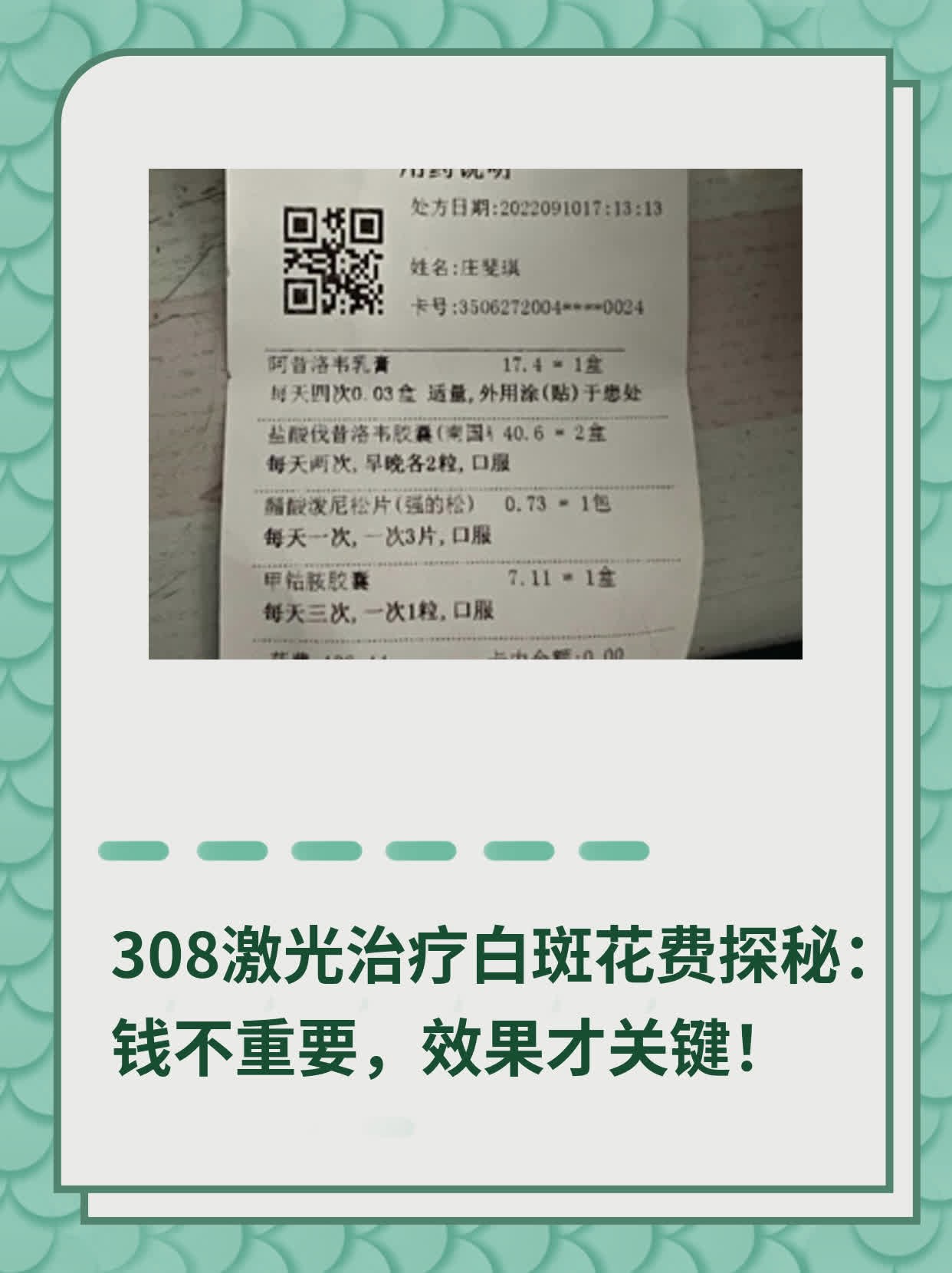 308激光治疗白斑花费探秘：钱不重要，效果才关键！