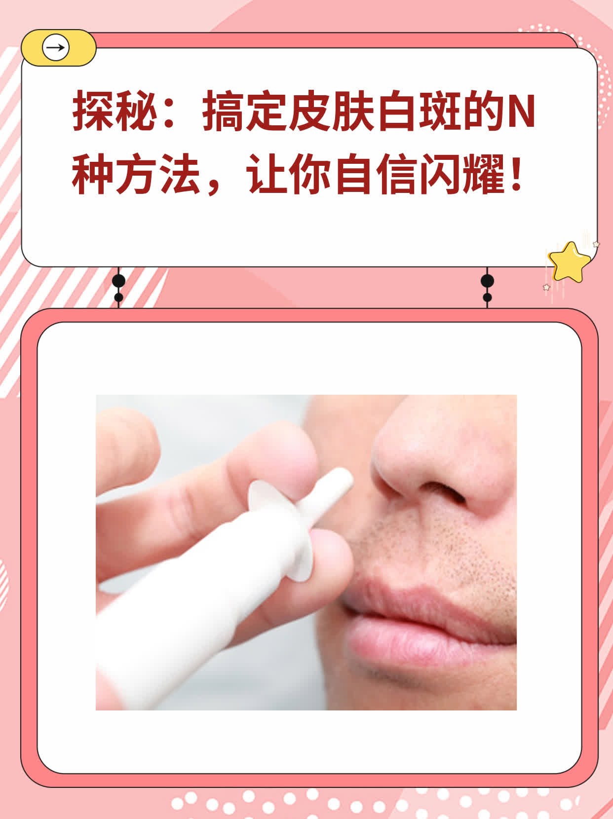 探秘：搞定皮肤白斑的N种方法，让你自信闪耀！