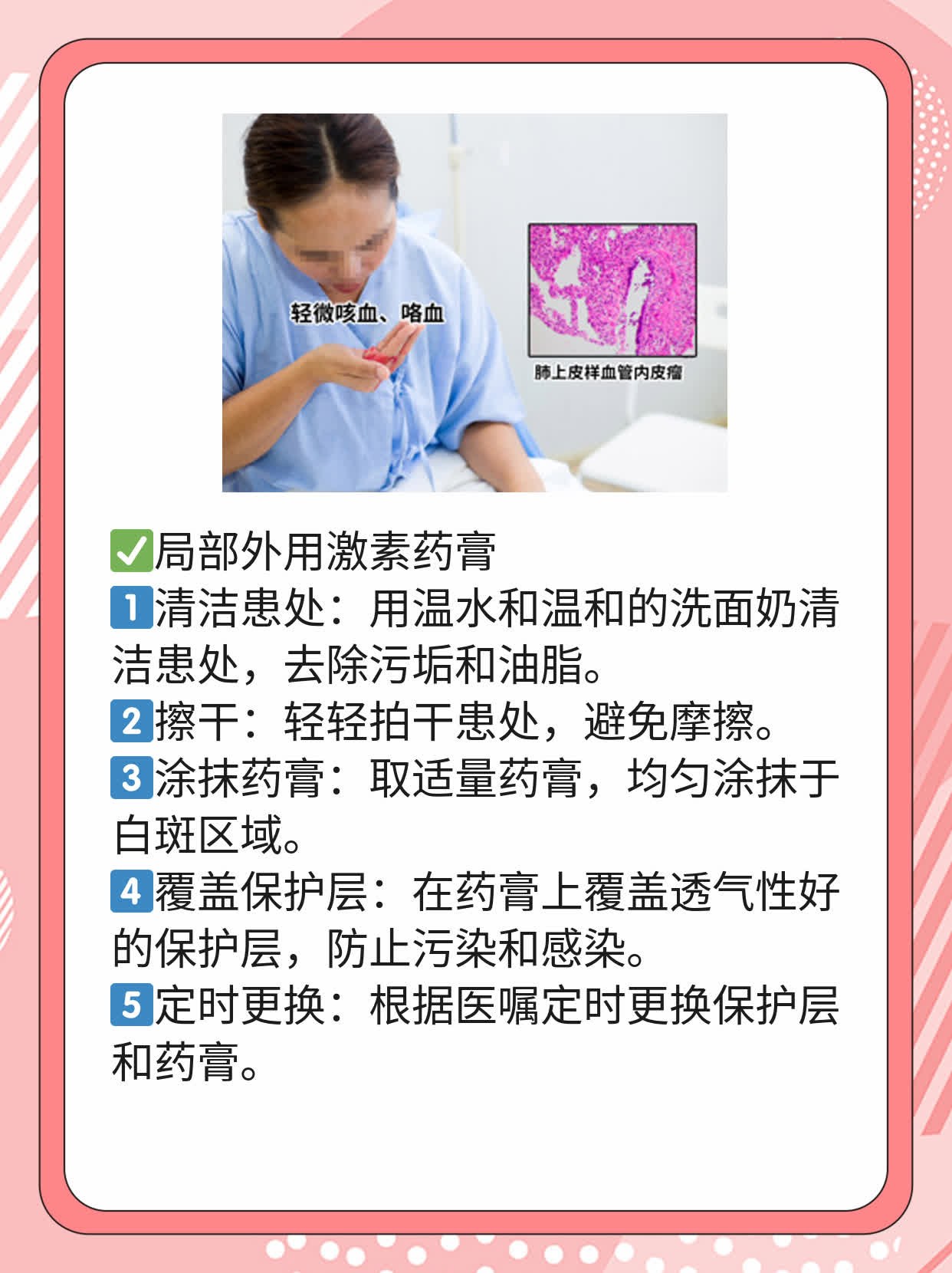 探秘：搞定皮肤白斑的N种方法，让你自信闪耀！