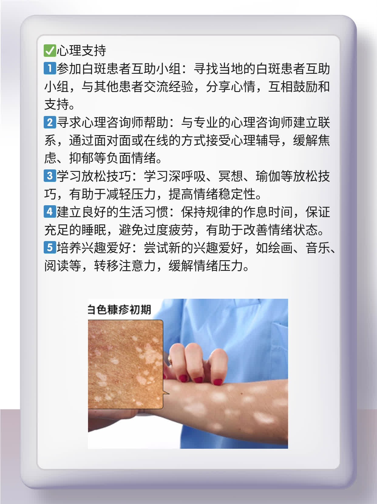 石家庄哪家医院白斑治的好