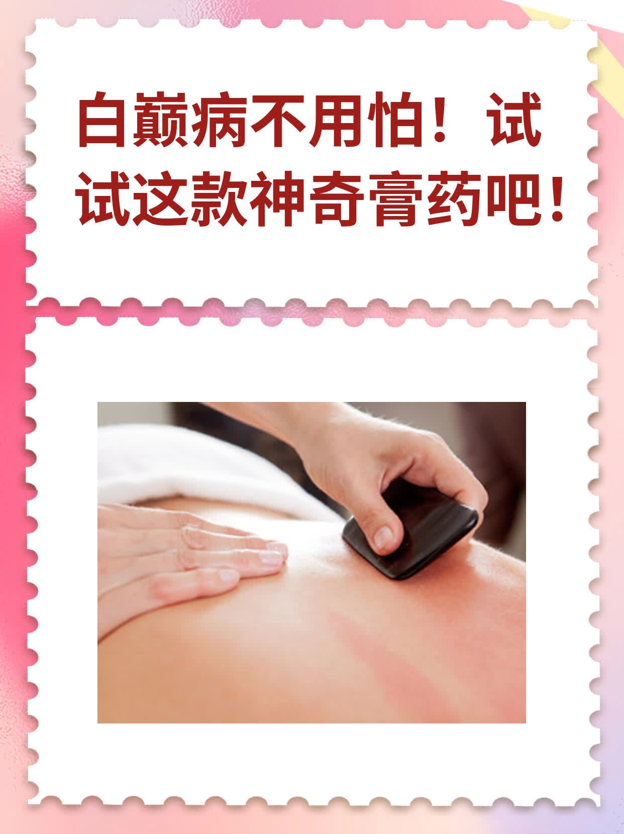 白巅病不用怕！试试这款神奇膏药吧！