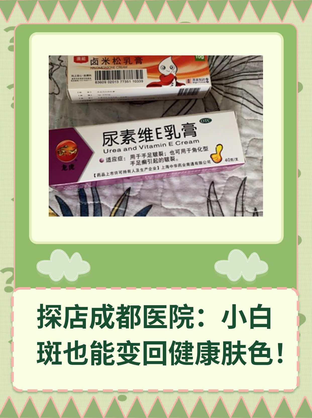 成都医院能看好白斑吗