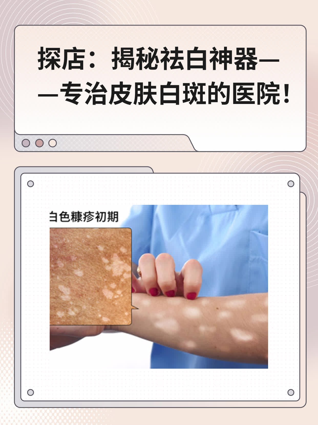 探店：揭秘祛白神器——专治皮肤白斑的医院！