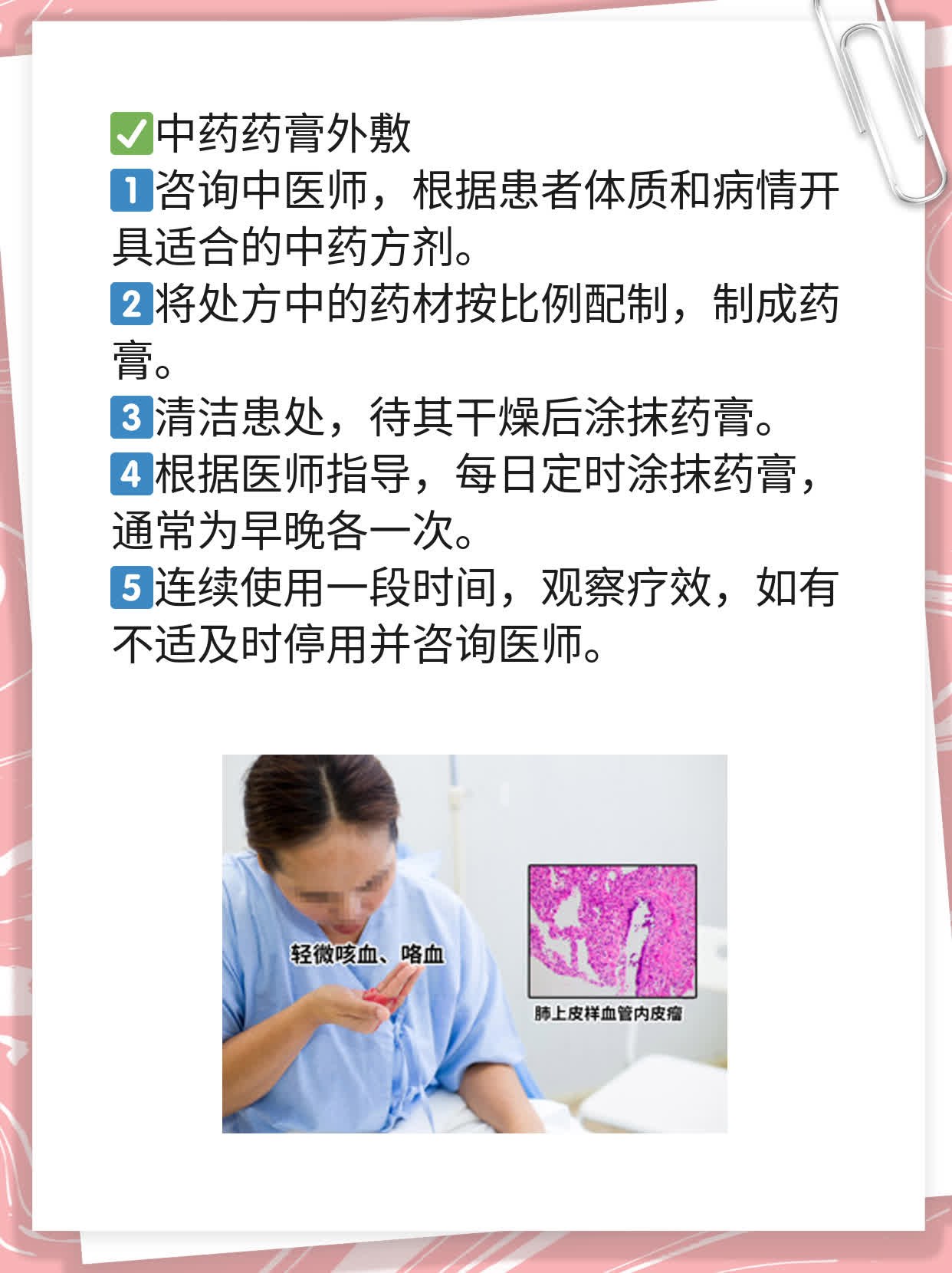 哪家医院能“秒杀”白斑病？探寻专业治疗白颠风的好去处！