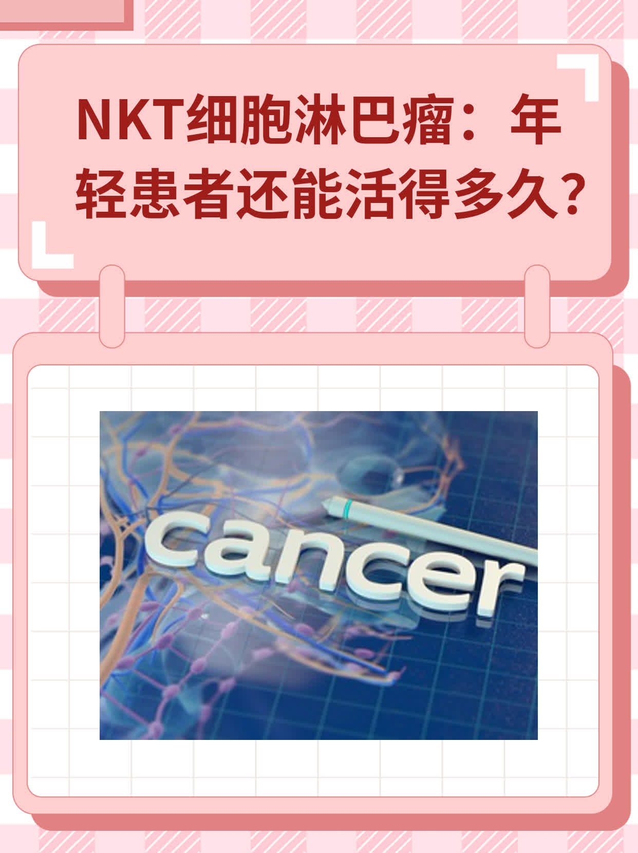 NKT细胞淋巴瘤：年轻患者还能活得多久？