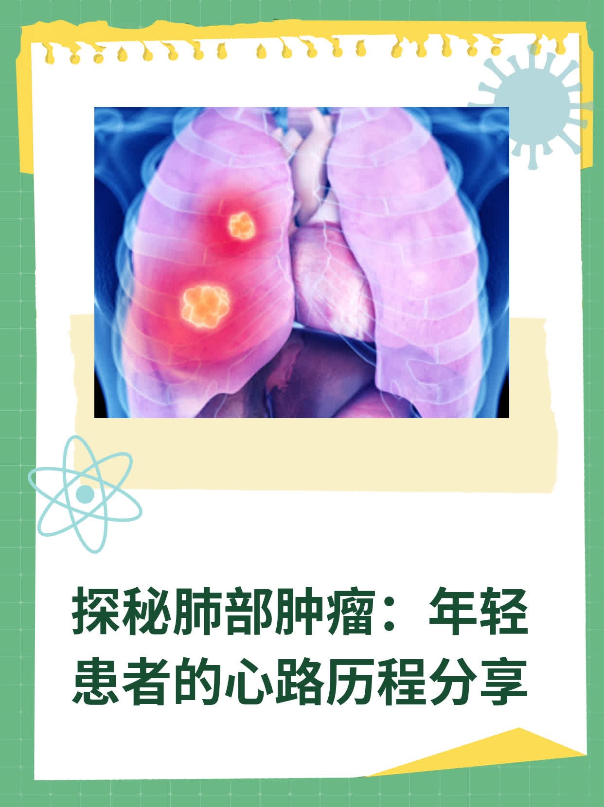 探秘肺部肿瘤：年轻患者的心路历程分享